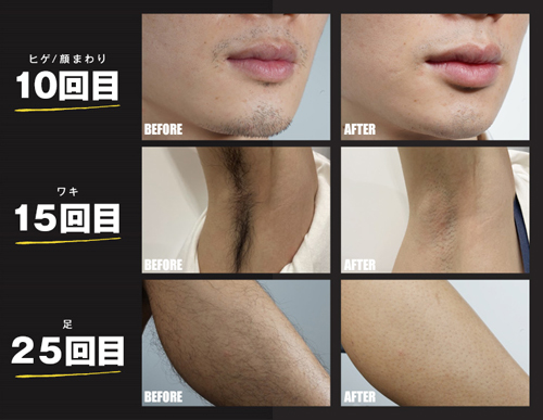 JOVS�̒E�ь���